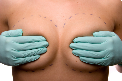 Bröstförstoring - operera brösten
